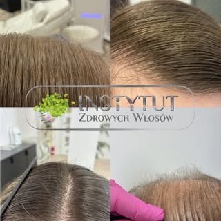 4 osoby. 4 różne przyczyny. Jeden efekt 💚

Każda z tych historii jest inna…
Ale wszystkie prowadzą 