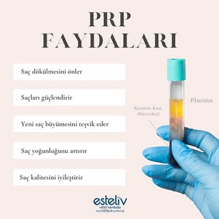 Saç dökülmesiyle mücadele edenler için PRP (Platelet Rich Plasma) tedavisi, son yıllarda en popüler 