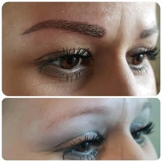 Micropigmentation at Redeem Clinic since 2012.