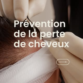 Prévenir la perte de cheveux, c’est possible ! 🌿

Adoptez les bons réflexes : alimentation équilibr
