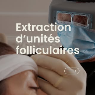 💡 Extraction d’unités folliculaires (FUE) : pour une greffe capillaire naturelle 

Vous cherchez un
