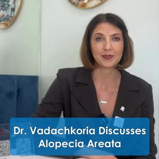 In this video, Dr. Salome Vadachkoria shares some insights into Alopecia Areata (AA), which is an au