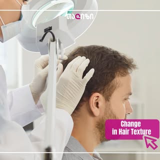 ❓ Can hair texture change after a hair transplant?

Hair texture is genetically determined and progr
