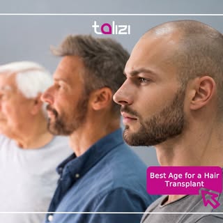 What is the best age for a hair transplant? 🤔

The truth is, there isn’t a single "perfect age." Wh