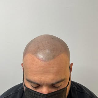 Anyone can stop early.
Professionals stay until it’s right.
Final result ✅

Book your consultation t