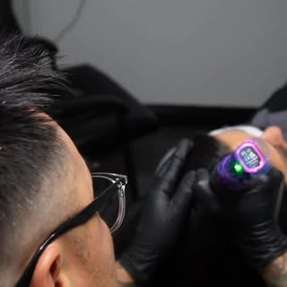 Tired of covering up thinning hair every day?
Scalp Micropigmentation (SMP) helps create the illusio