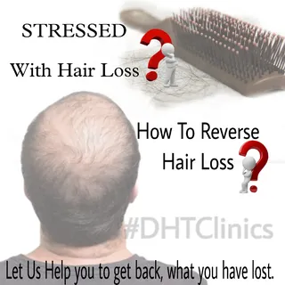 Do you get evidence of falling hairs from comb, towel?
Hair Loss treatment are natural safe Effectiv
