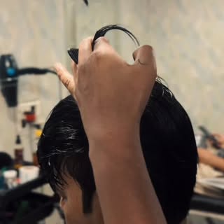 #hairpatchdelhi #hairpatch #hairtransformation #transformation