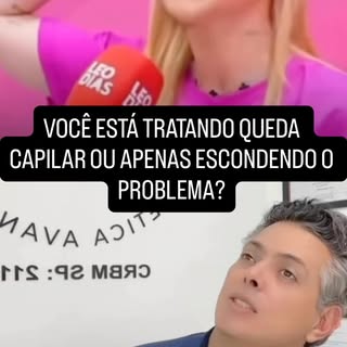 Eu tive alopecia 3 vezes e tudo por causa do estresse.

Quando ouvi a Virgínia falando isso, eu pens