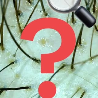 Você não trata o que não consegue identificar.

Na tricologia, os maiores erros começam antes mesmo 