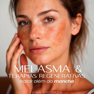Melasma não é apenas uma mancha. É uma pele em estado de inflamação crônica.
Quando tratamos só clar