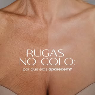 Por que as rugas aparecem no colo?

A pele do colo é fina, delicada e está constantemente exposta ao