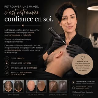✨ Retrouver une image, c’est souvent retrouver confiance en soi.

La tricopigmentation permet aujour