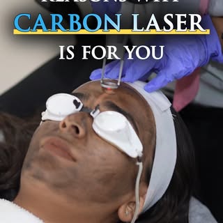 ✨ Reasons Why Carbon Laser is for You! ✨

Is your skin looking dull, uneven, or marked by acne scars