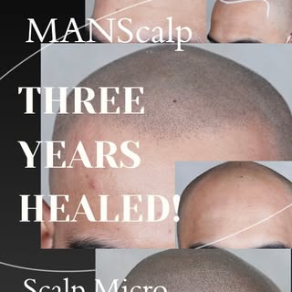 What I do in each session is reflected throughout the lifespan of my clients' SMP. I place each indi