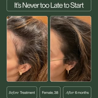 We know the first step is the hardest, which is exactly why your first consultation is on us. ⁠
⁠
He