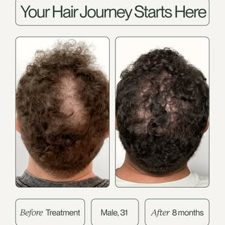 From day one to maintenance care 8 months later, we are with you every step of the way. ⁠
⁠
Head to 