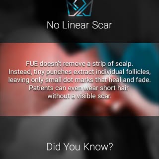 🤔 Worried about how you're going to look after an FUE? Don't worry!⁠
Unlike FUT, FUE leaves no line
