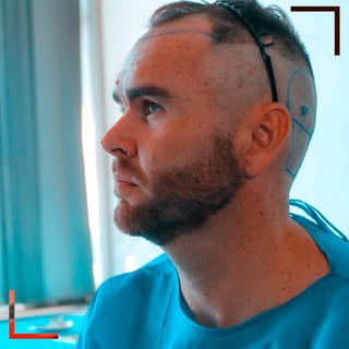 💭 It’s completely normal to feel a little nervous when you start looking into getting a hair transp