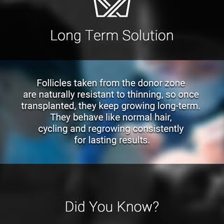 Looking for a fix that actually lasts?⁠
A hair transplant moves strong, permanent follicles that kee