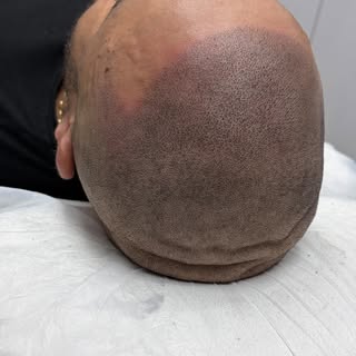 🔥 MISSING THAT BARBER SHOP SHAPE-UP FEELING? 🔥✂️

You know the feeling… 👌

Fresh out of the barbe