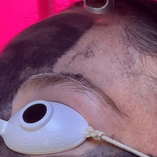 Hollywoodpeel tiene una acción inmediata en tu piel ; ideal para realizarlo previo a eventos como bo