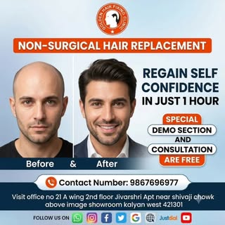 Golden hair fixing......
Contact n0.9867696977
Visit:- office no.21 A wing 2nd floor Jivarshri Apt n