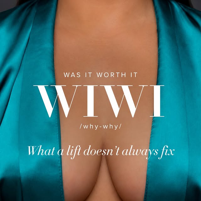 Was It Worth It? NaturaBra® Edition.

Traditional breast lifts have been performed for over a centur