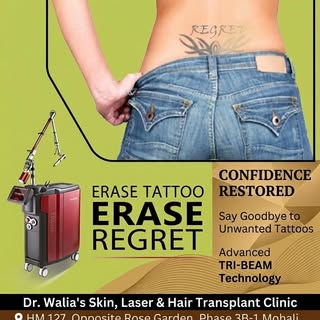 ✨ Regret happens, but your ink doesn't have to be permanent! Whether you're looking to clear a clean