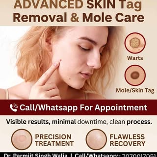 ✨ Clear, smooth, and worry-free skin is just a quick visit away! 🛑🔍 Skin tag and mole removal is a