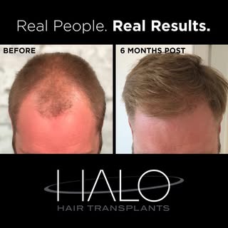 Life changing and so fun to these results 🙌🏻🙌🏻