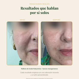 Detrás de cada resultado hay mucho más que un procedimiento.

Hay una valoración detallada, un diagn