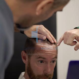 Expert Personal Guidance in French with Exceptional Ongoing Support for your Hair Transplant journey