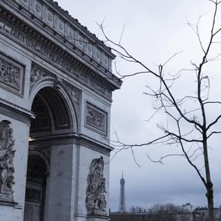 ✨Nouveau | Greffe de cheveux à Paris : intervention encadrée + suivi (J+1)

Greffe de cheveux réalis