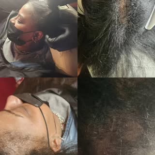 #stop #hairloss #miniaturization #in #its #tracks #wehave a #solution #schedule #yourappointment #co