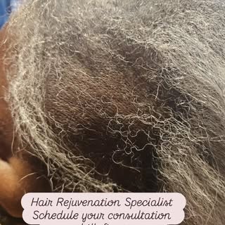 #hairlosssolutions #androgenicalopecia #follicles #stimulation #healthy 

www.phillyfinest.com