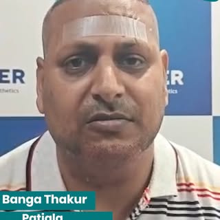 From Hair Loss to a Fresh Start – Hear It from Our Happy Patient!

Watch our happy patient from Pati