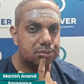 "I Got My Hairline Back!" – A Real Story, Real Results.

Hear Mr. Manish Anand shares his honest exp