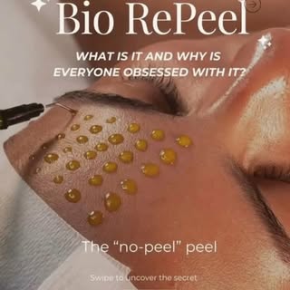 🪄No peeling. No downtime. Just instant, glass skin glow. 

Meet the BioRePeel. 🪄 The revolutionary