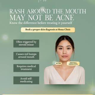 Not every rash around the mouth is acne. ✨

Perioral dermatitis isn’t acne. It often appears as red 