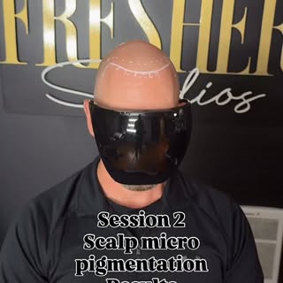 If you’re tired of having movies rather than dreams, come see me! I can fix that hairline for you. 
