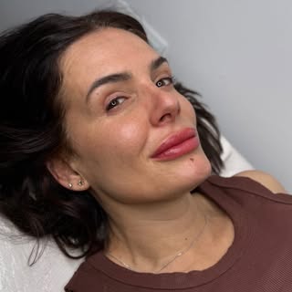Mira como luce la Micropigmentación de labios de manera real.

En su caso @saraperezmicropigmentacio