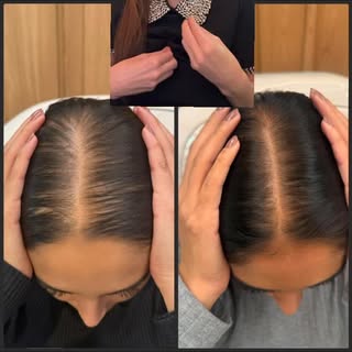 Tratar o cabelo também é sobre saúde e auto estima!