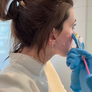 Brincadeiras a parte, o efeito embelezador do botox vai durar em média 3 a 4 meses, mas o que eu sem