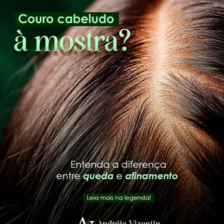 Você já parou pra reparar no risco do seu cabelo e achou ele mais largo do que era antes?
Isso não é