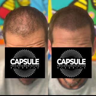 New Style for a New Life 🔬
Grâce à une implantation pigmentaire ultra-précise, la micropigmentation
