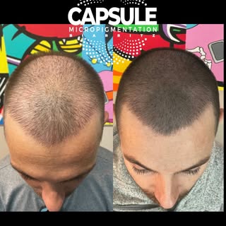 ⚡️New style for a new Life⚡️✨ Effet Densité – Résultat Naturel & Ultra Réaliste ✨

Zones clairsemées