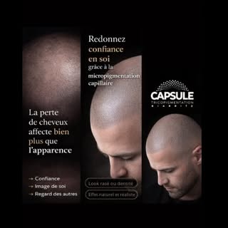 Perte de cheveux, calvitie, zones clairsemées…
Ce n’est pas qu’un problème esthétique.
C’est souvent