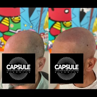 ⚡️NEW STYLE FOR A NEW LIFE⚡️Redéfinition de la ligne frontale,
densité homogène,
illusion parfaite d