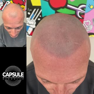 ⚡️NEW STYLE FOR A NEW LIFE⚡️Grâce à la tricopigmentation, cette transformation permet de redessiner 